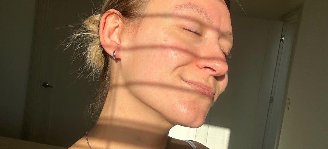 autumn skincare for sensitive skin